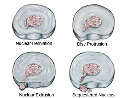  Dr. Ansari - Best Spine Surgen in Dubai 