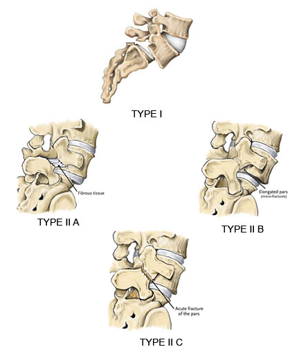 Dr. Ansari - Spine Specialist